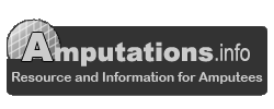 Amputations